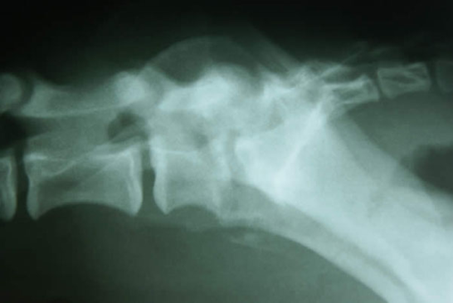 Discospondylitis in a Boxer