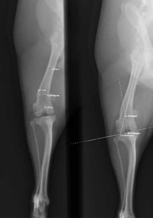 Radiographs showing measurement of femoral varus