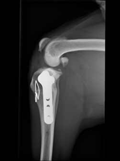 Cranial closing wedge