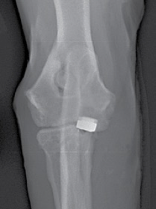 Post operative X ray