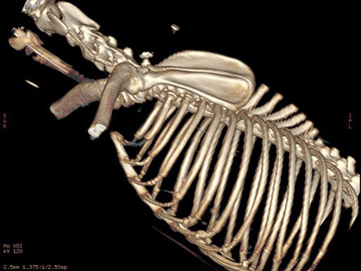 3D CT Thorax