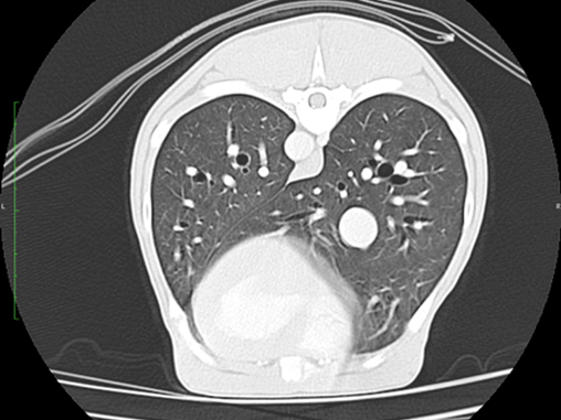 CT Image of Lung